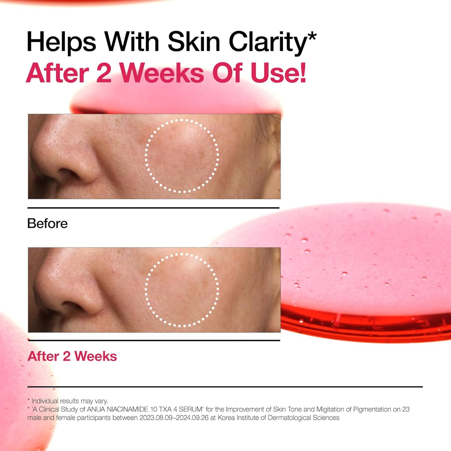 Anua - Niacinamide 10% + TXA 4% Serum 30ml